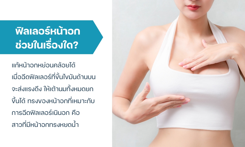 ฟิลเลอร์หน้าอก ช่วยในเรื่องใด?