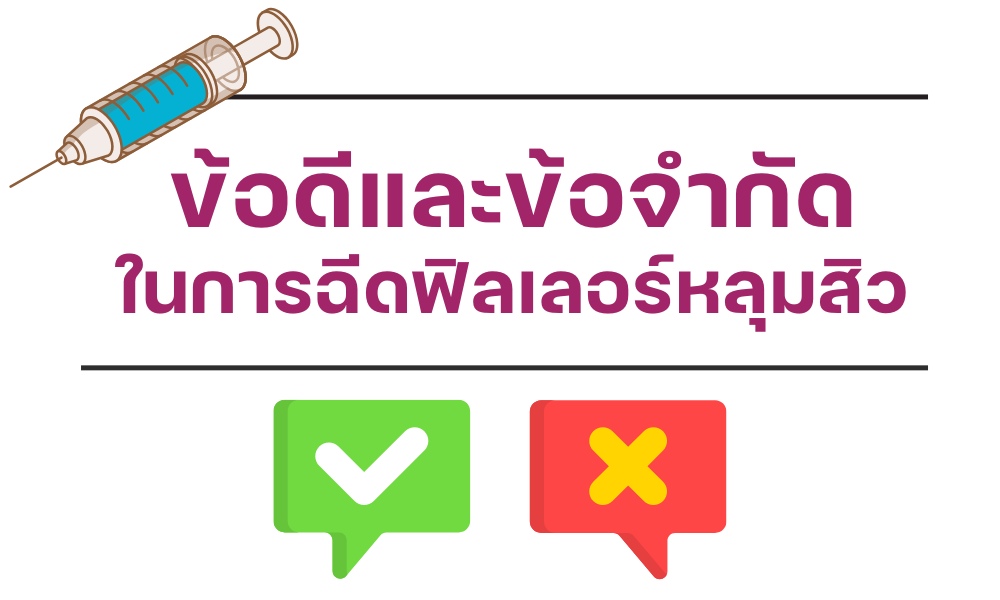 ข้อดีและข้อจำกัด ในการฉีดฟิลเลอร์หลุมสิว