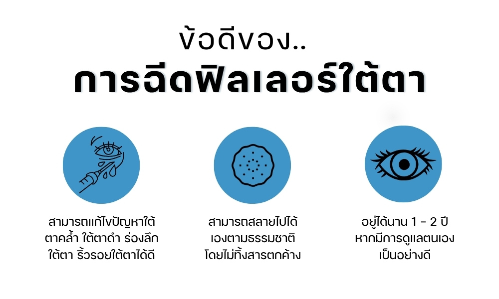 ข้อดีของการฉีดฟิลเลอร์ใต้ตา