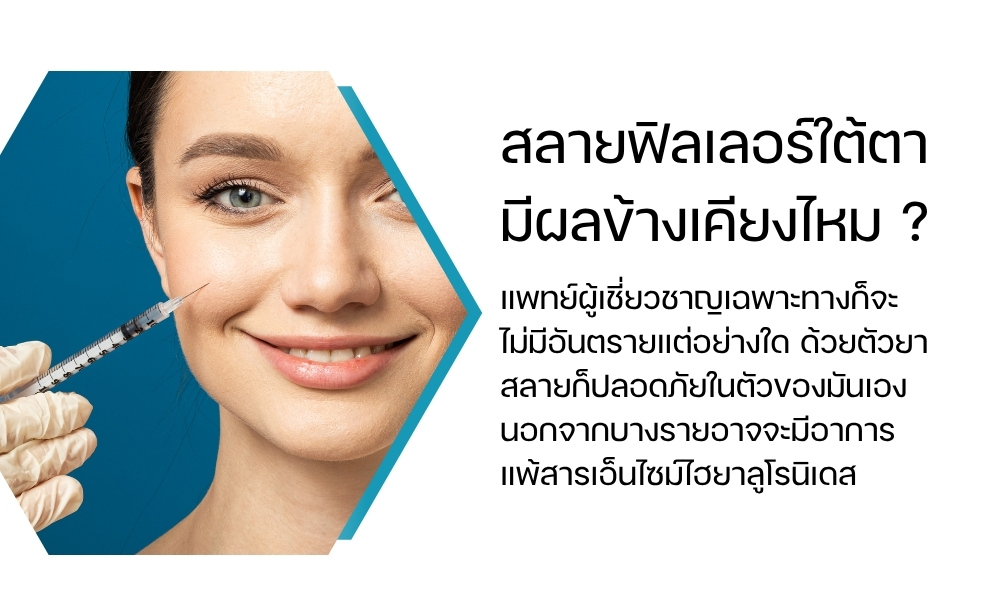 สลายฟิลเลอร์ใต้ตา มีผลข้างเคียงไหม ?