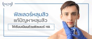 ฟิลเลอร์หลุมสิว แก้ปัญหาหลุมสิว