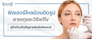 ฟิลเลอร์ไหลย้อยผิดรูป