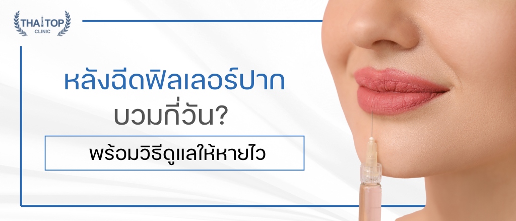หลังฉีดฟิลเลอร์ปากบวมกี่วัน? พร้อมวิธีดูแลให้หายไว
