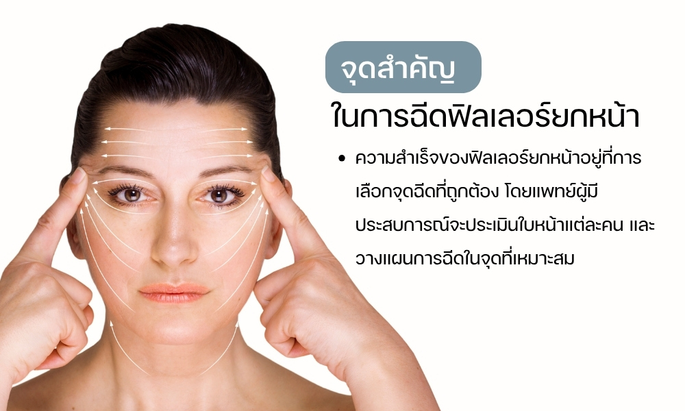 จุดสำคัญในการฉีดฟิลเลอร์ยกหน้า