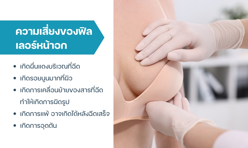ความเสี่ยงของฟิลเลอร์หน้าอก