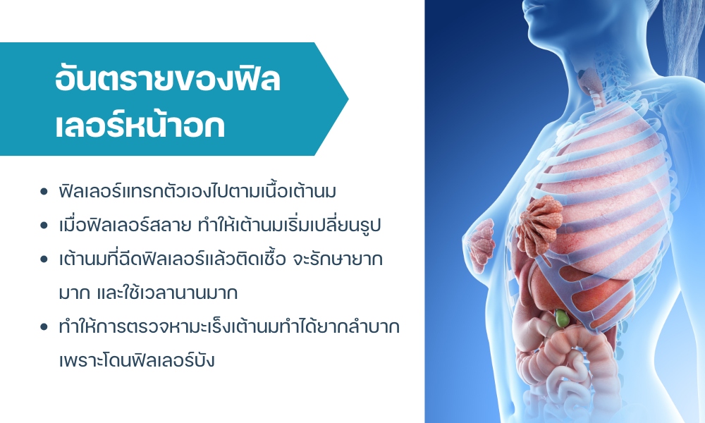 อันตรายของฟิลเลอร์หน้าอก