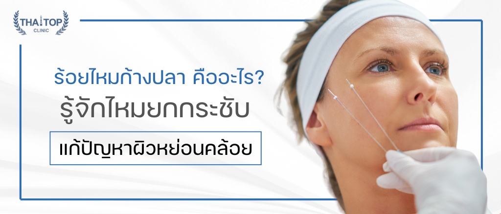 ร้อยไหมก้างปลา คืออะไร? รู้จักไหมยกกระชับ แก้ปัญหาผิวหย่อนคล้อย