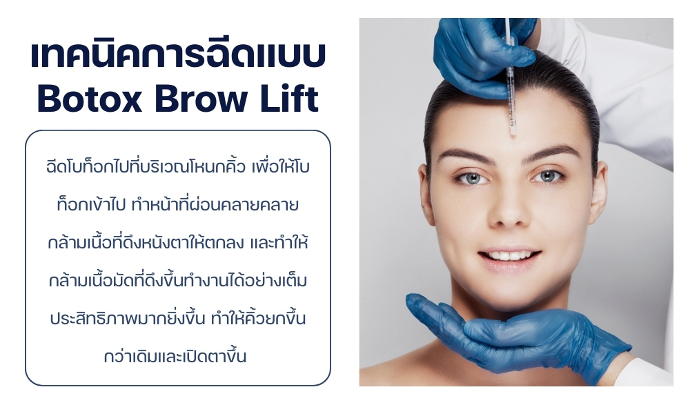 เทคนิคการฉีดแบบ Botox Brow Lift