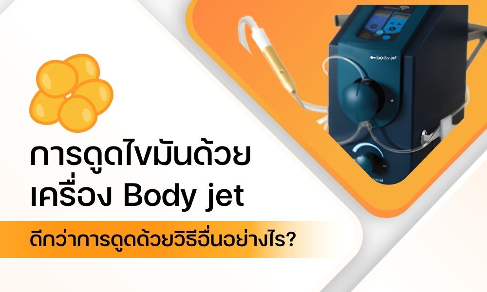 ดูดไขมันด้วยเครื่อง Body Jet เทคโนโลยีพลังน้ำ เจ็บน้อย