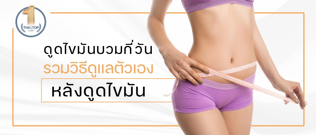 ดูดไขมันบวมกี่วัน