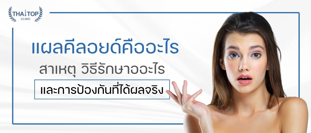 แผลคีลอยด์ คืออะไร สาเหตุ วิธีรักษา และการป้องกันที่ได้ผลจริง