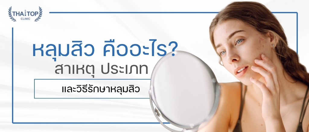 หลุมสิว คืออะไร? สาเหตุ ประเภท และวิธีรักษาหลุมสิว