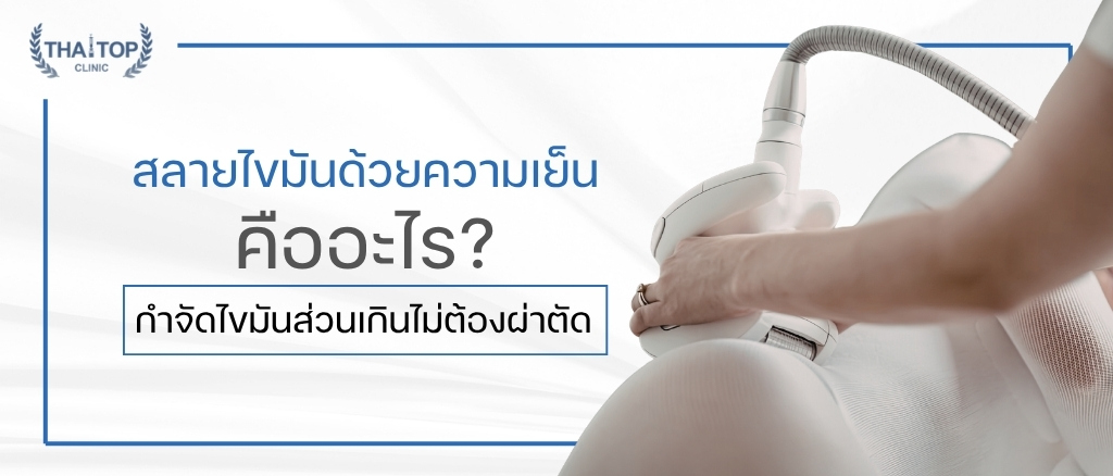 สลายไขมันด้วยความเย็น คืออะไร? กำจัดไขมันส่วนเกินไม่ต้องผ่าตัด
